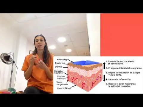 kinesiotape  ¿q son y como funcionan esas vendas de colores?