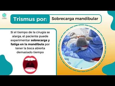 ¿EN QUE CONSISTE EL TRISMUS?