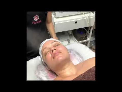 Facial Mandocomplex 40