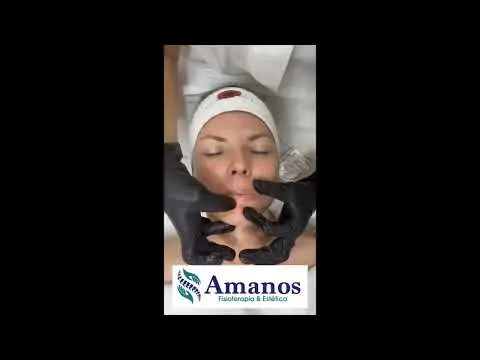 protocolo tratamiento labios acido hialuronico    amanos castro urdiales