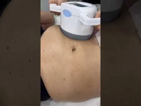 Q Shape corporal