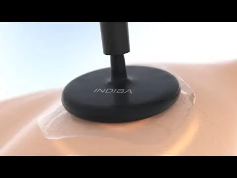 Qué es y cómo funciona Indiba