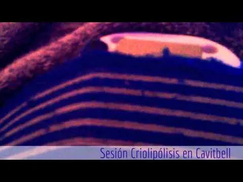 Criolipólisis Cavitbell