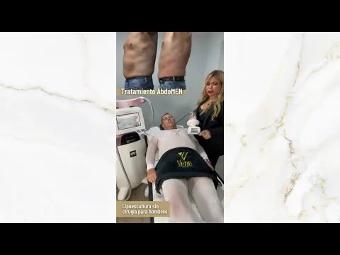 AbdoMEN, la lipoescultura sin cirugía para hombres