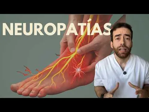 NERVIO DAÑADO: Todo sobre la NEUROPATÍA | Dolor de manos y pies