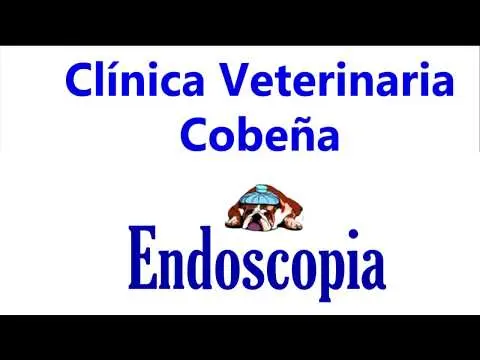Endoscopia, extracción de aguja