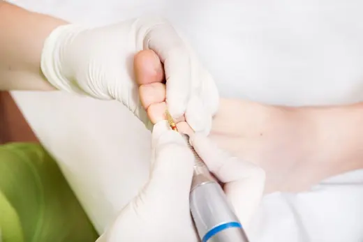 Clinica Podologica Mireia Serrano. Atendemos pie diabetico seguridad social. Podologo El Masnou