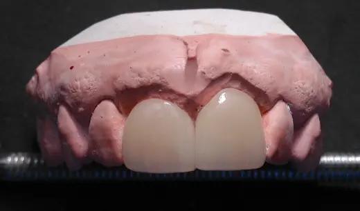 Lab. Dental Juan I. Gomez Lopez